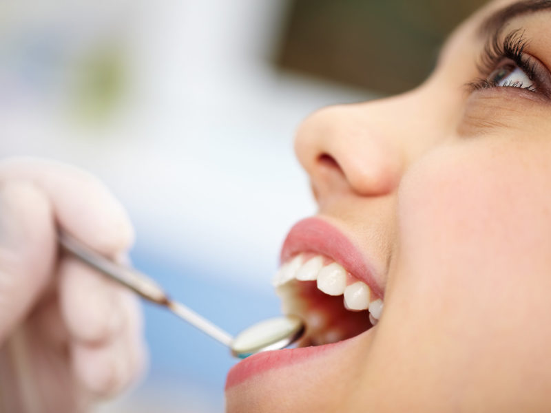 Close-up of a pretty patient with her mouth open